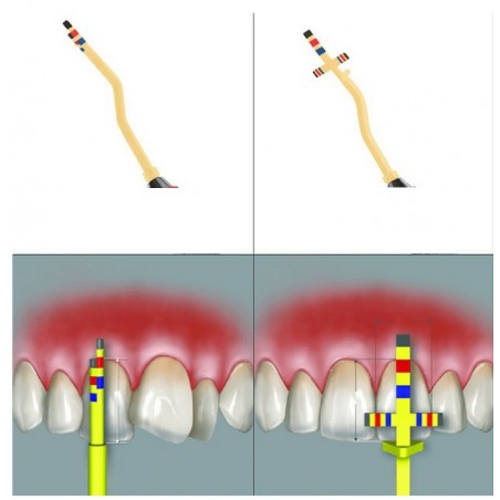 PROPORTION GAUGE DR.
