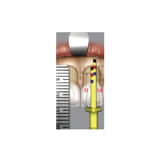 CROWN LENGTHENING GAUGE DR.
