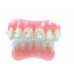 ATTACCHI D.B. CERAMICI AD ESAURIMENTO