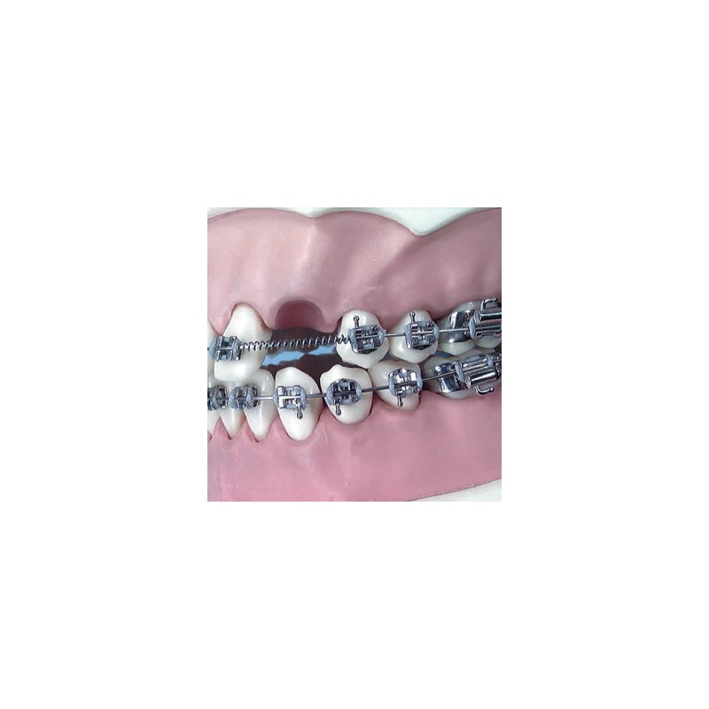 MOLLE APERTE 009 X 036