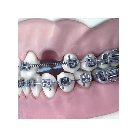 MOLLE APERTE 012 X 030